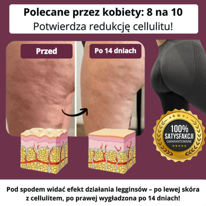 CelluFree  – legginsy antycellulitowe wysmuklające sylwetkę