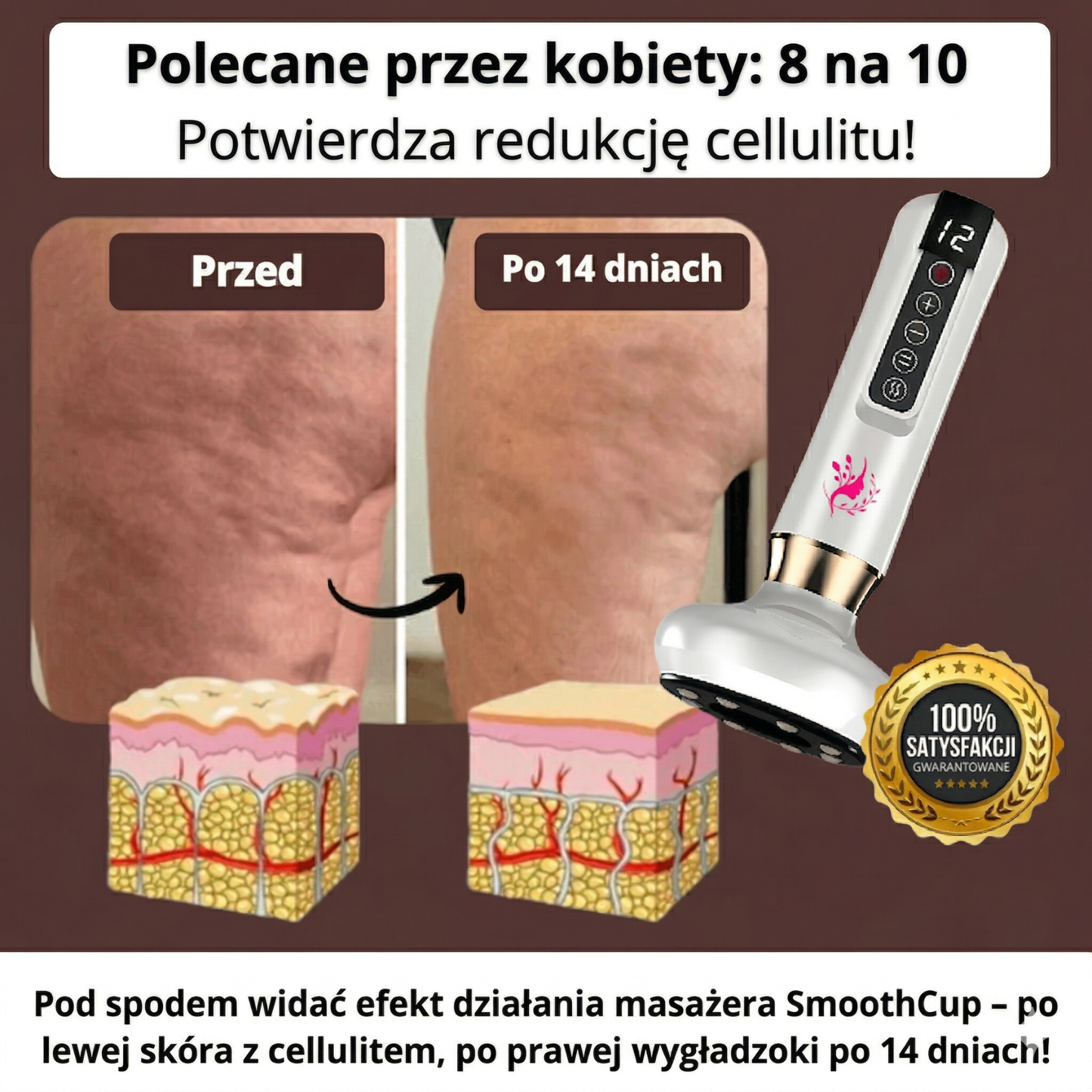 SmoothCup - antycellulitowy masażer próżniowy
