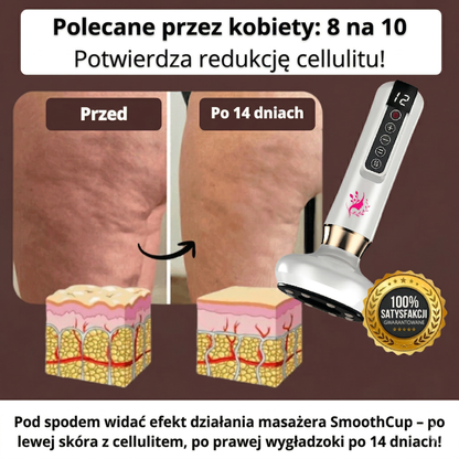 SmoothCup - antycellulitowy masażer próżniowy