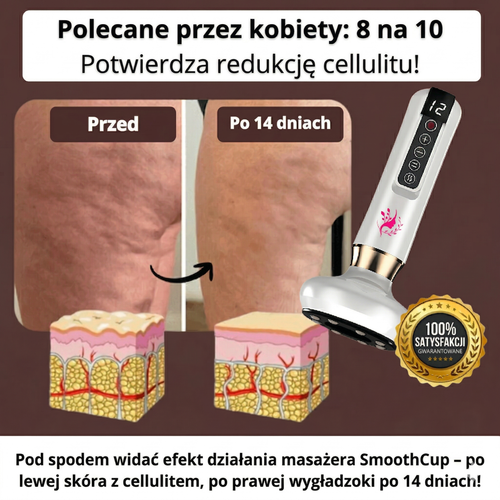 SmoothCup - antycellulitowy masażer próżniowy