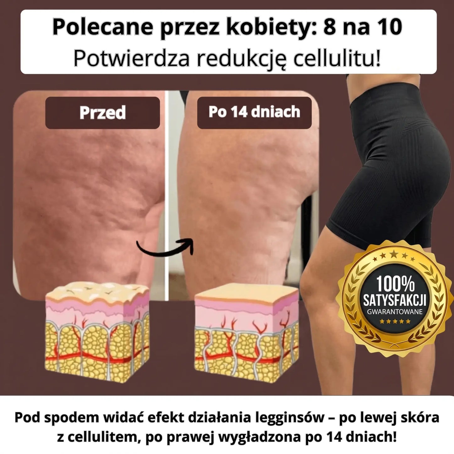 Cellufree - Krótkie antycellulitowe leginsy na lato