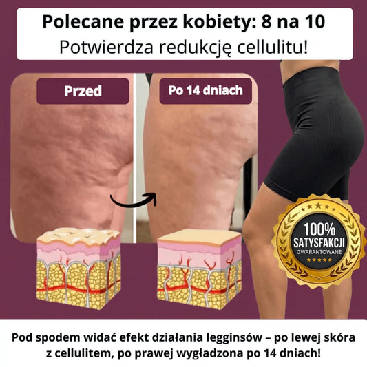 Cellufree - Krótkie antycellulitowe leginsy na lato